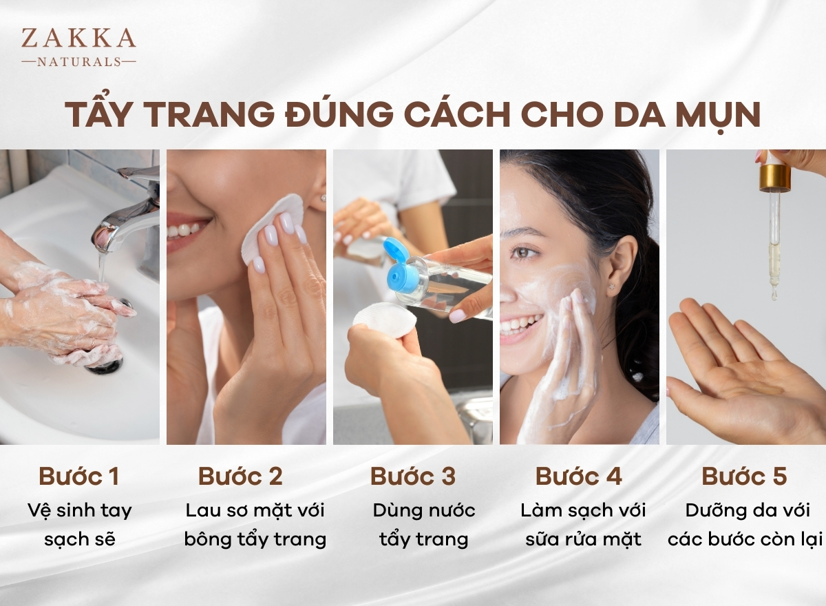 Hướng dẫn tẩy trang đúng cách cho da mụn sạch khỏe