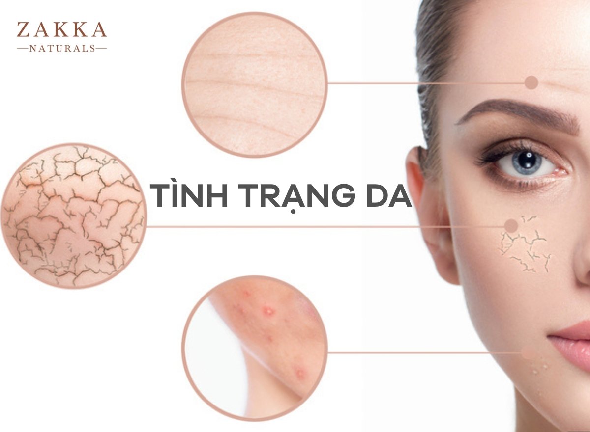 Retinol Là Gì? Dùng Retinol Bao Lâu Thì Ngưng?