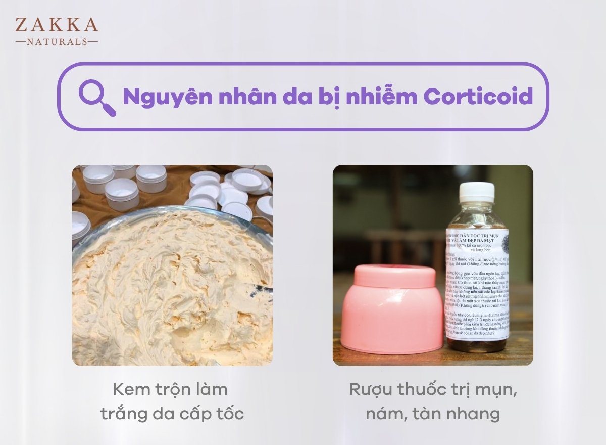 7 Cách Phục Hồi Da Nhiễm Corticoid Triệt Để Tại Nhà