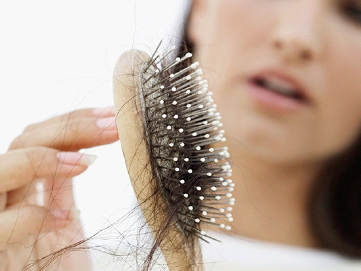 Nguyên nhân rụng tóc nam là gì? Giải pháp khắc phục hiệu quả - VIỆN CẤY TÓC  TỰ THÂN NEWHAIR BY KHƠ THỊ