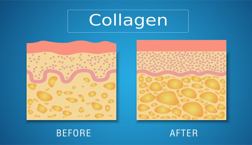 collagen nâng đỡ mô da