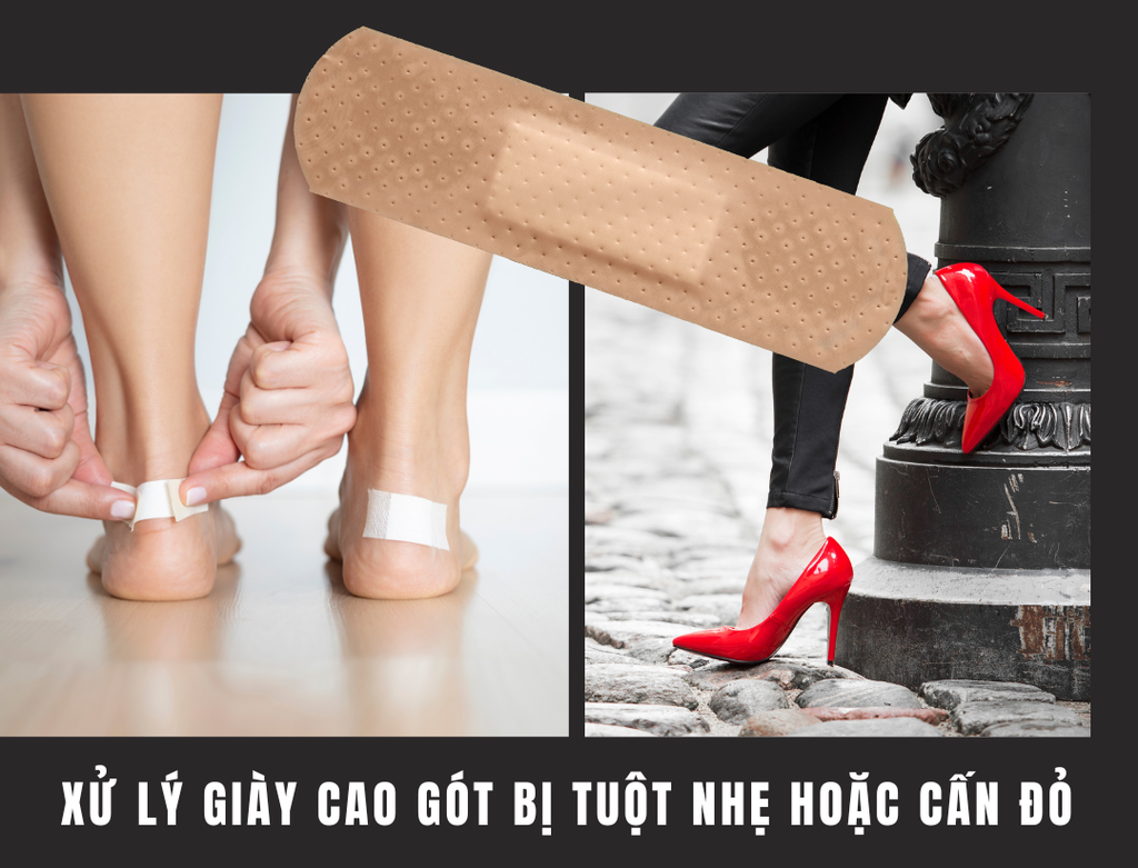 Xử lý giày cao gót bị rộng tuột nhẹ hoặc bị cấn đỏ bằng băng keo cá nhân