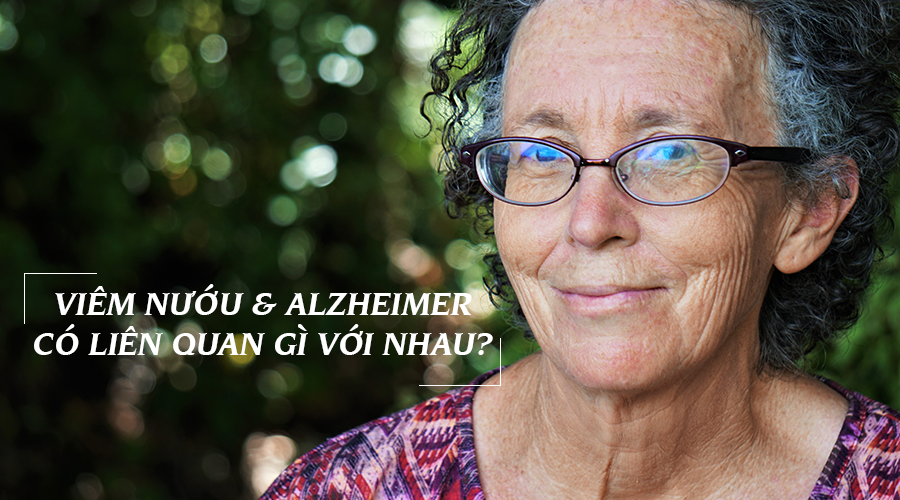 Sớm điều trị viêm nướu có thể làm chậm quá trình phát triển bệnh Alzheimer