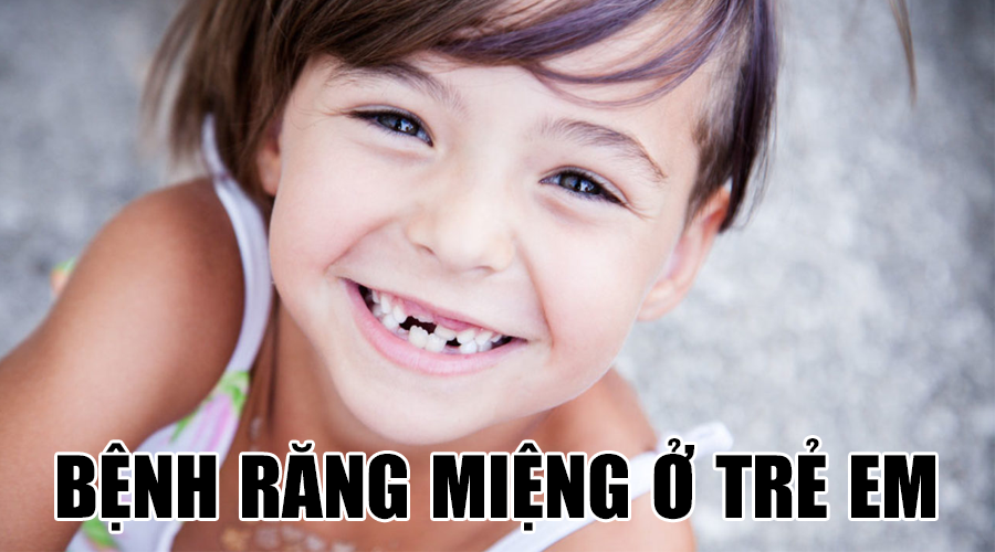 Các bệnh răng miệng thường gặp ở trẻ nhỏ