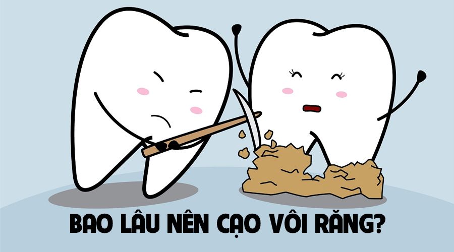 Bao nhiêu lâu thì nên cạo vôi răng?