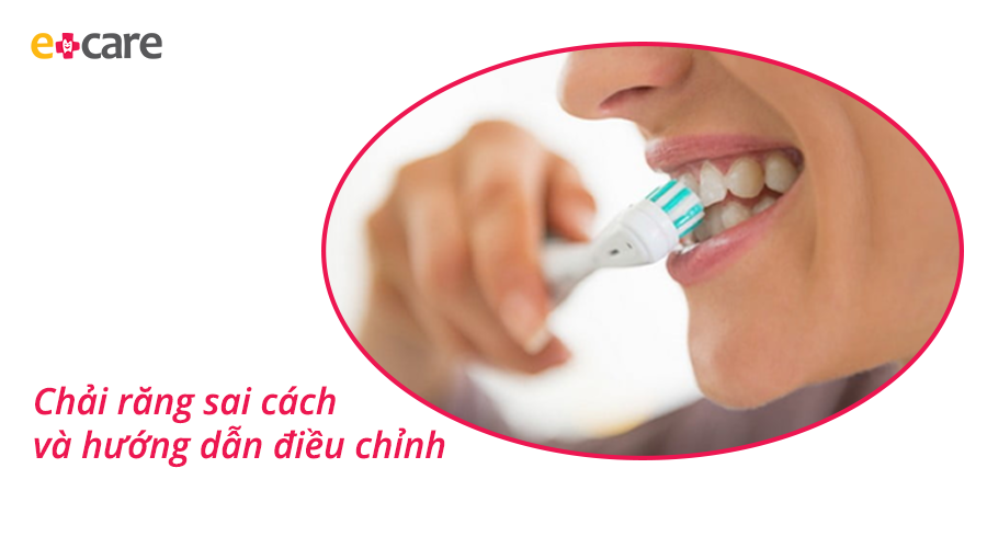 Chải răng sai cách và hướng dẫn điều chỉnh