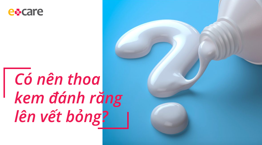 Thoa kem đánh răng để trị bỏng - nên hay không?