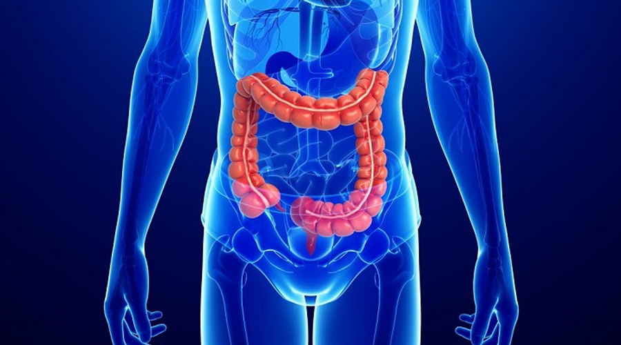 Bệnh Crohn có thể gây tử vong không?