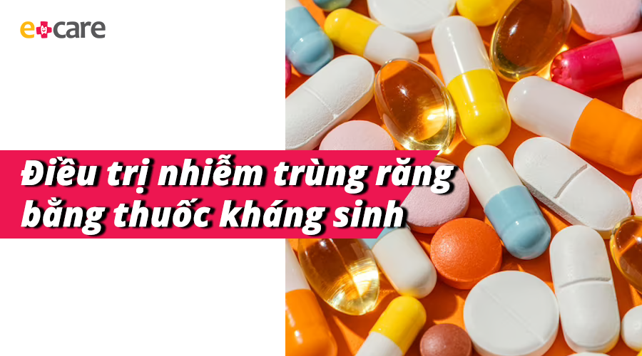 Một vài thuốc kháng sinh hiệu quả với việc điều trị nhiễm trùng răng