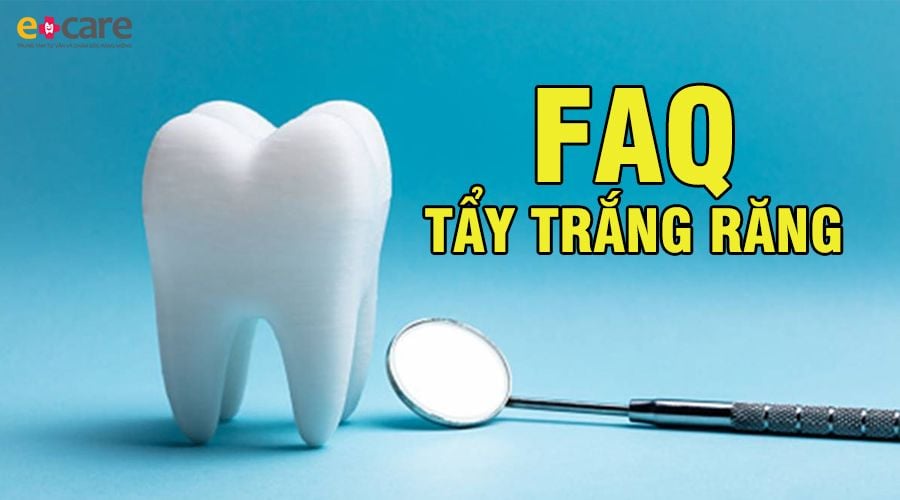 6 câu hỏi về làm trắng răng do nha sĩ trả lời