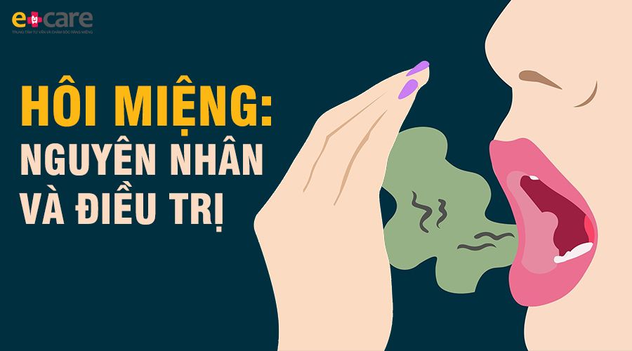 Các nguyên nhân và phương pháp điều trị hôi miệng