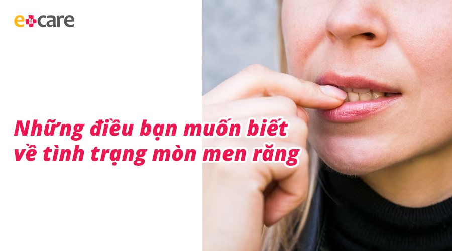 Những điều bạn muốn biết về tình trạng mòn men răng – ECARE STORE
