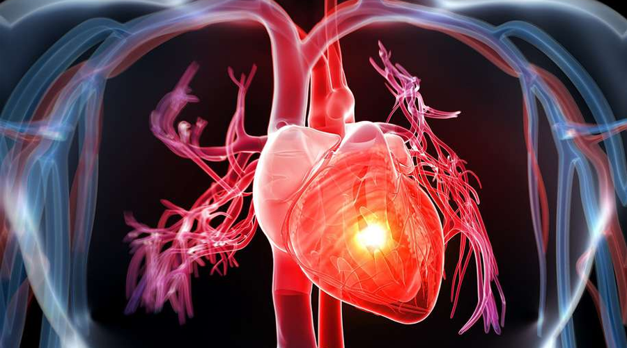 Các triệu chứng ban đầu của suy tim là gì?