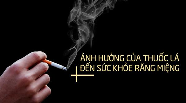 Ảnh hưởng của thuốc lá đến sức khỏe răng miệng