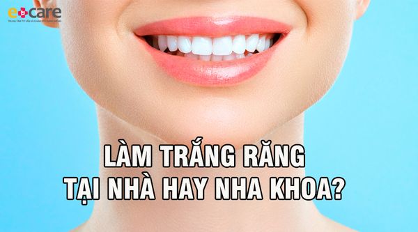Làm trắng răng tại nhà hay tại nha khoa?