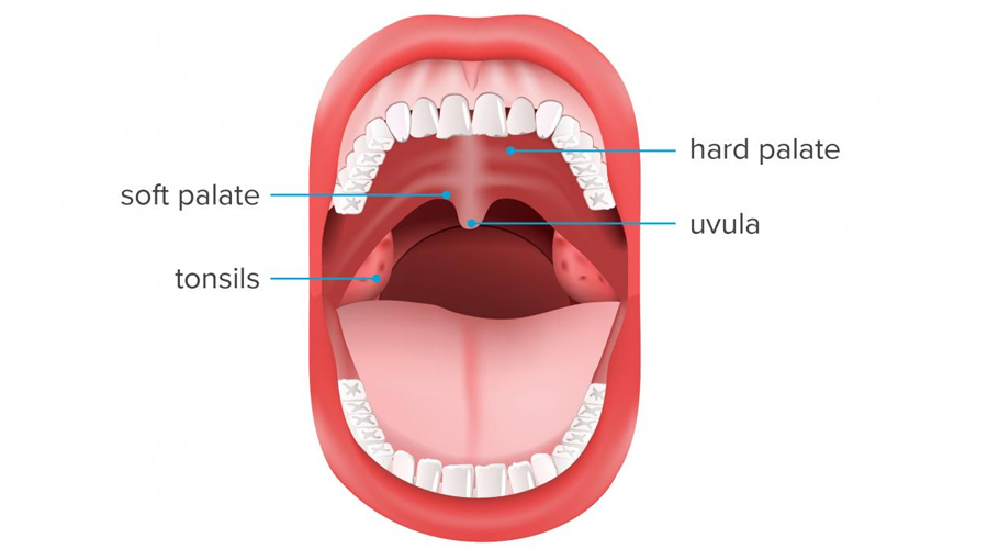 Những điều cần biết về vòm họng