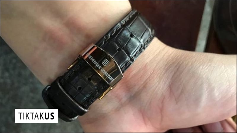 Dấu hiệu nhận biết đồng hồ quá chặt