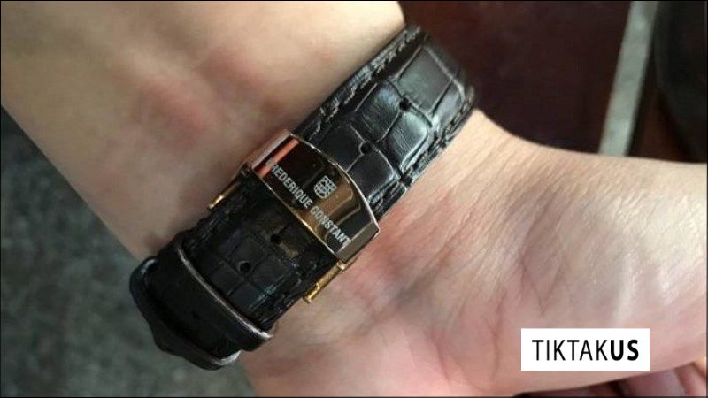 Tình trạng ngứa khi đeo đồng hồ có thể xuất phát từ nhiều yếu tố khác nhau