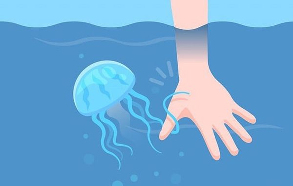 Cảnh báo mùa sứa khi tắm biển - Những điều lưu ý khi gặp phải con sứa biển