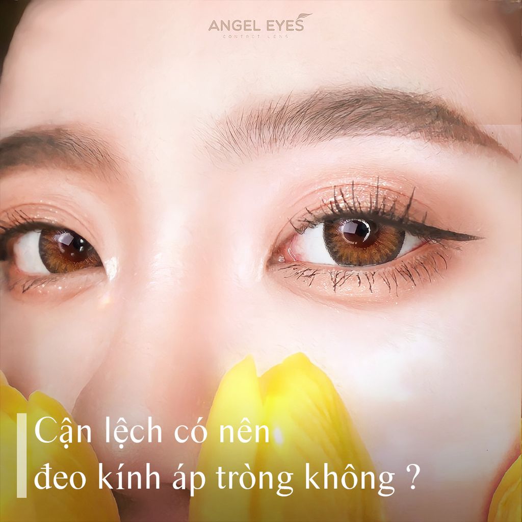 CẬN LỆCH CÓ NÊN ĐEO KÍNH ÁP TRÒNG (LENS) KHÔNG?