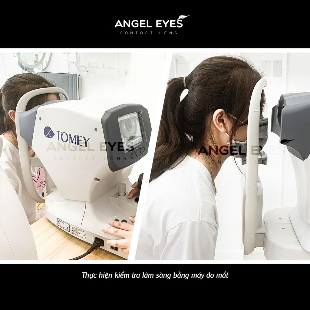 NGƯỜI MUA KÍNH ÁP TRÒNG CẬN THỊ CẦN LƯU Ý GÌ?