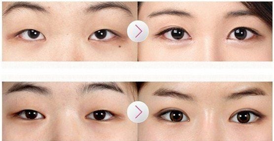 Một số cách làm mắt to hơn cho bạn gái - Kính áp tròng ANGEL EYES cho mắt nhạy cảm | Kính sát tròng nhãn khoa
