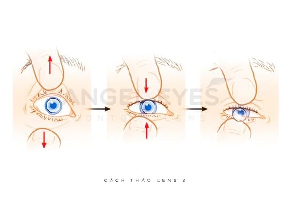 cach-thao-lens