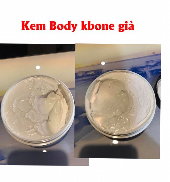 mỹ phẩm kbone giả