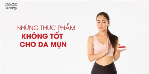 NHỮNG THỰC PHẨM KHÔNG TỐT CHO DA MỤN