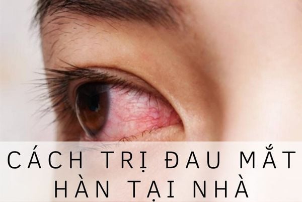 6 cách khắc phục đau mắt hàn tại nhà an toàn hiệu quả