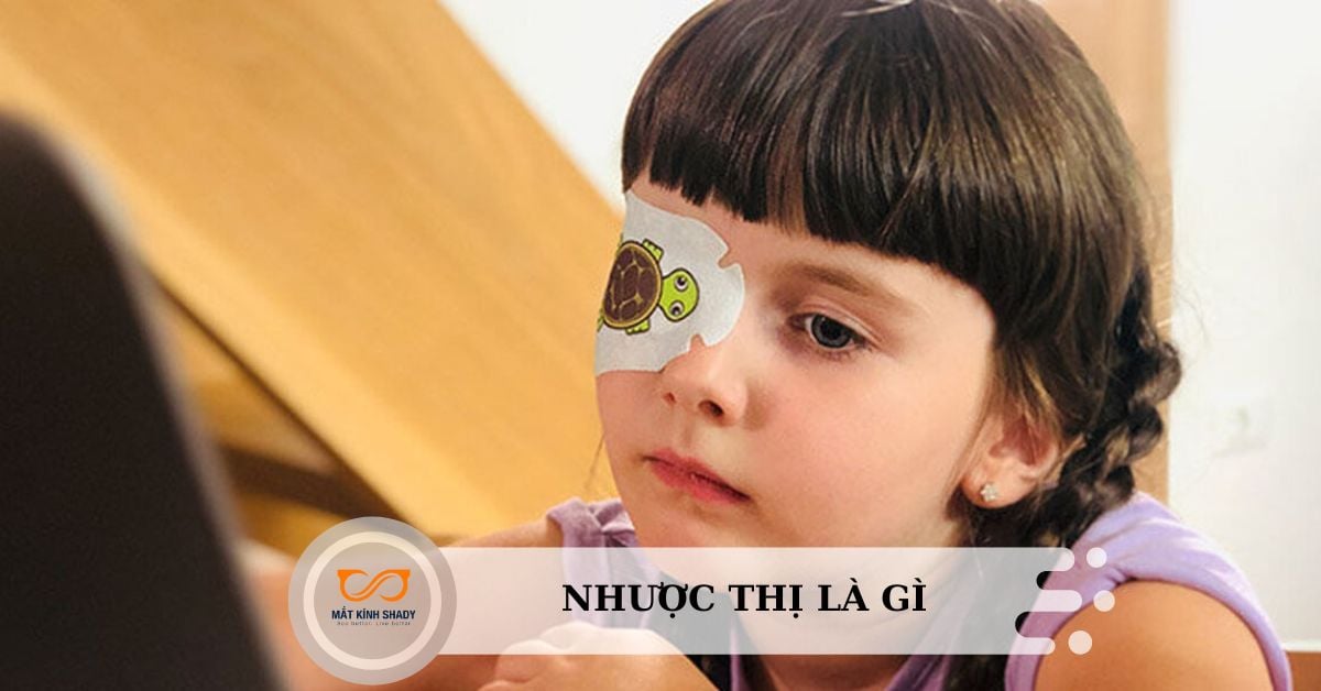 [GIẢI ĐÁP] Nhược thị là gì? Nhược thị có chữa được không?