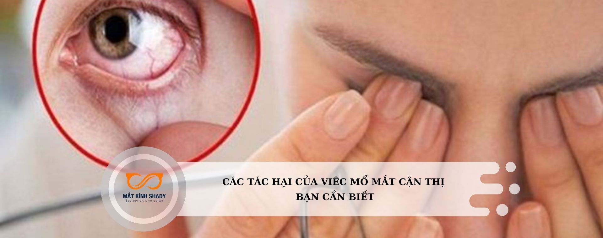 CÁC TÁC HẠI CỦA VIÊC MỔ MẮT CẬN THỊ BẠN CẦN BIẾT