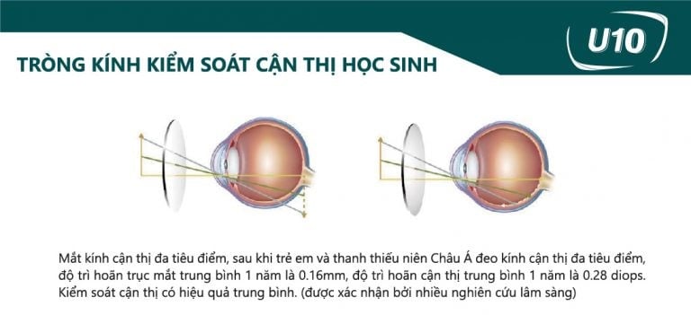 Tròng Kính Kiểm Soát Cận Thị Học Sinh Chemi Myopia Control Lens 1.59 PC U10