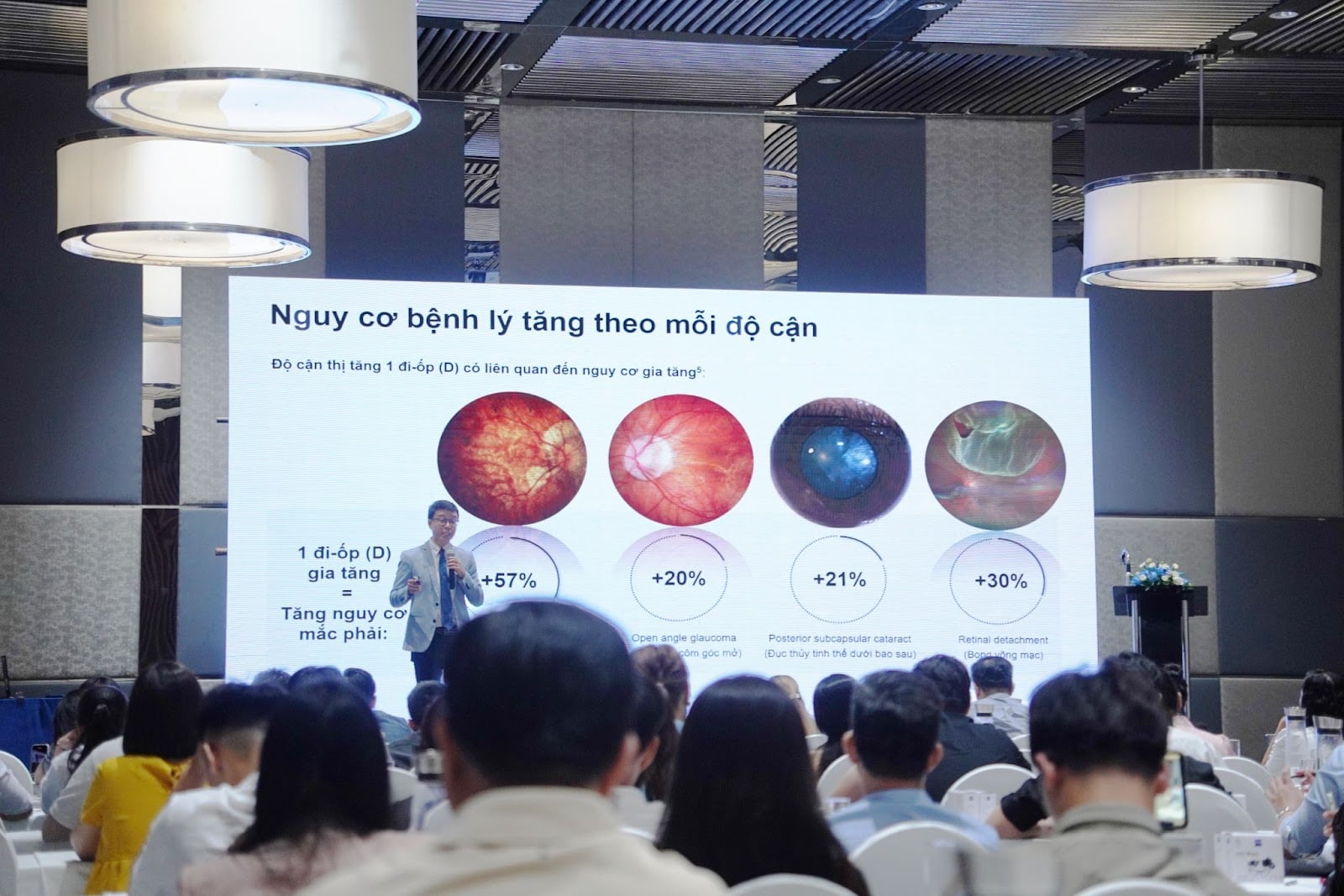 Mắt Kính Shady Đồng Hành Cùng Zeiss MyoCare Trong Quản Lý Tiến Triển Cận Thị Trẻ Em