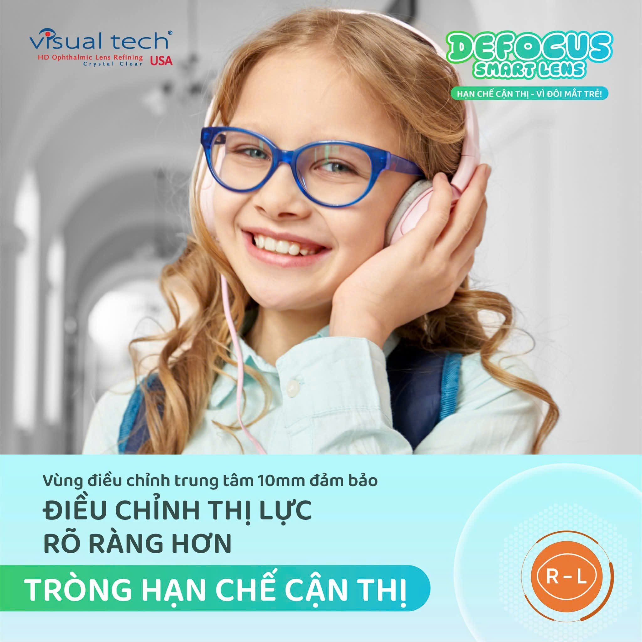 Tròng Kính Kiểm Soát Tiến Triển Cận Thị Trẻ Em Defocus Smart Lens