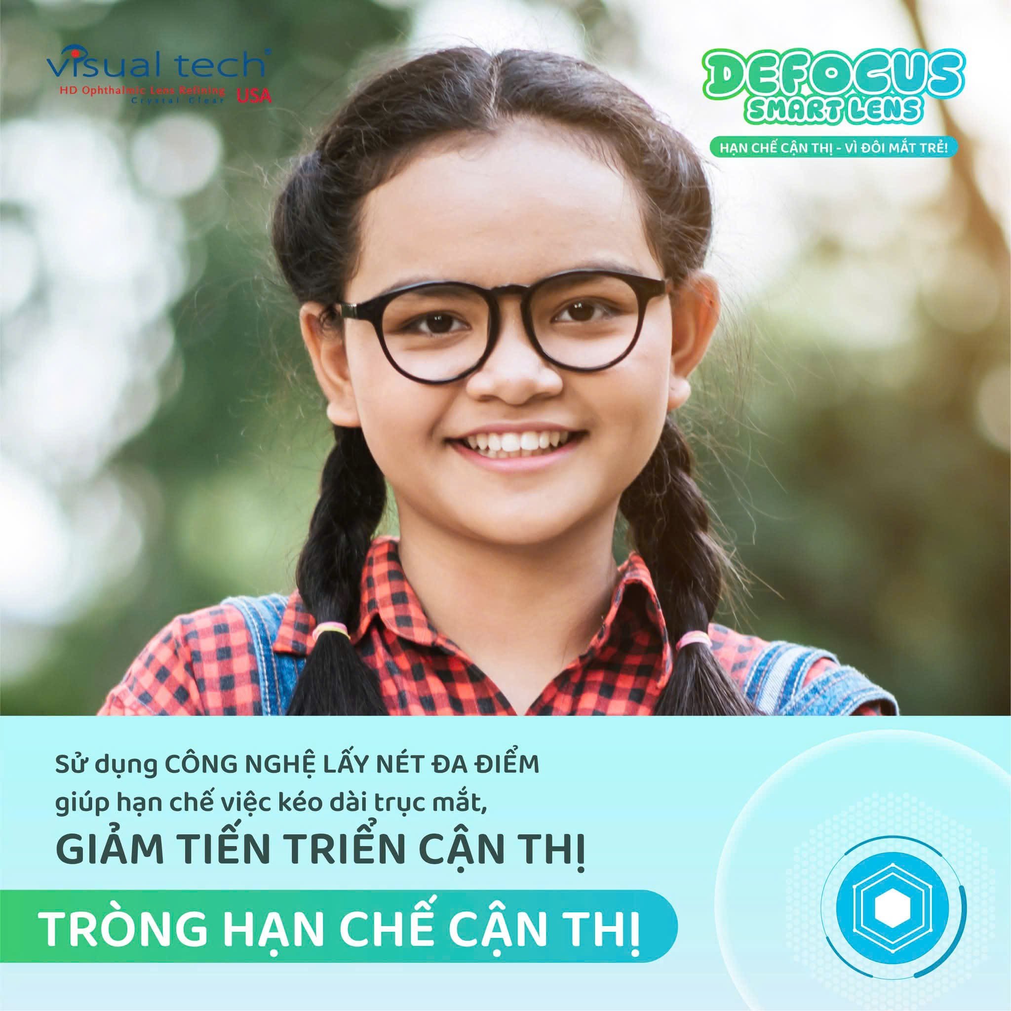 Tròng Kính Kiểm Soát Tiến Triển Cận Thị Trẻ Em Defocus Smart Lens
