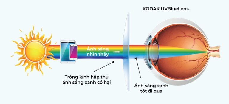 Tròng Kính Siêu Mỏng Chống Ánh Sáng Xanh UV Blue Lens Kodak 1.67