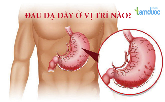Đau Dạ Dày Ở Vị Trí Nào? Triệu Chứng Và Cách Phòng Tránh Hiệu Quả