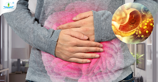 Phòng ngừa tiến triển bệnh dạ dày mãn tính với hỗn dịch dạ dày Curmin Nano