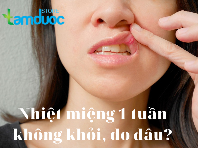 Nhiệt Miệng 1 Tuần Không Khỏi Do Đâu? Điều Trị Thế Nào?