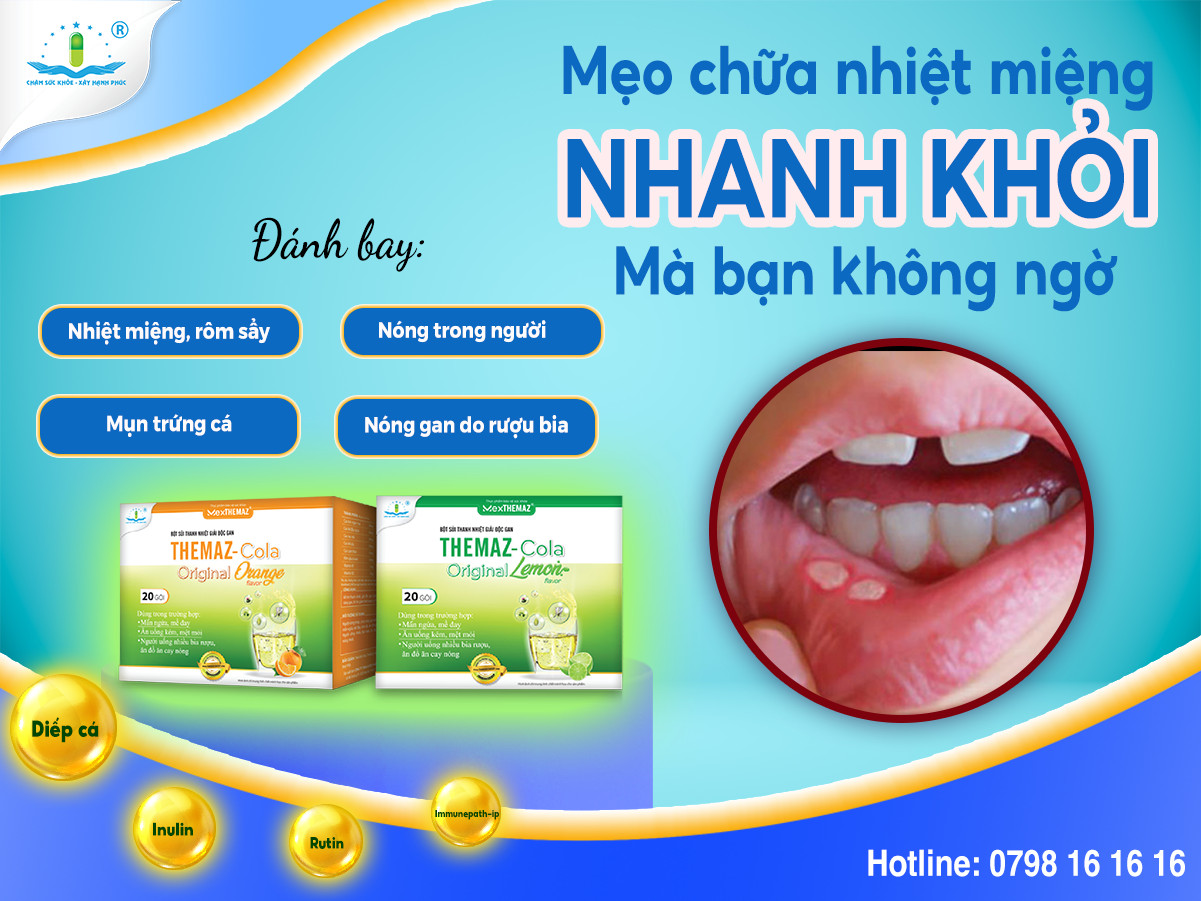 MẸO CHỮA NHIỆT MIỆNG NHANH KHỎI MÀ BẠN KHÔNG NGỜ