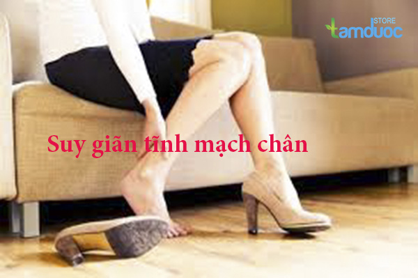 Bệnh Suy Giãn Tính Mạch Là Gì? Nguyên Nhân Và Cách Điều Trị