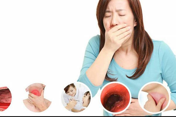 Trào Ngược Dạ Dày Gây Ung Thư Thực Quản Có Hay Không?