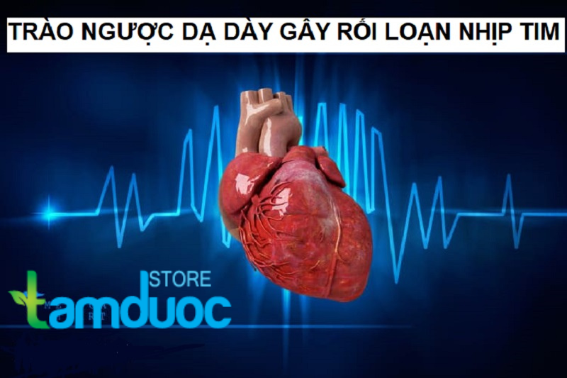 Trào Ngược Dạ Dày Làm Tim Đập Nhanh Có Hay Không?