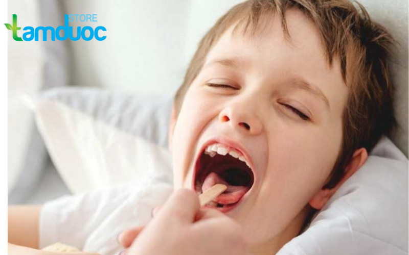 Trẻ Em Bị Nhiệt Miệng Nên Ăn Gì Và Những Điều Nên Biết