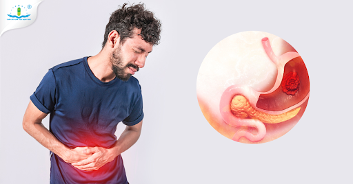 Những lợi ích của Nghệ Gel Nano Bình Vị Chữ N đối với người bệnh dạ dày