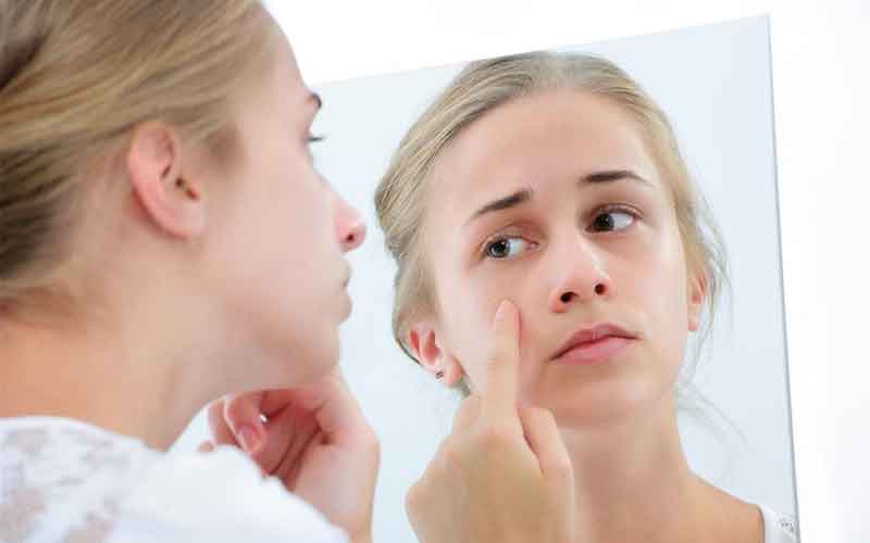 Uống Giải Độc Gan Có Trị Mụn Được Không?