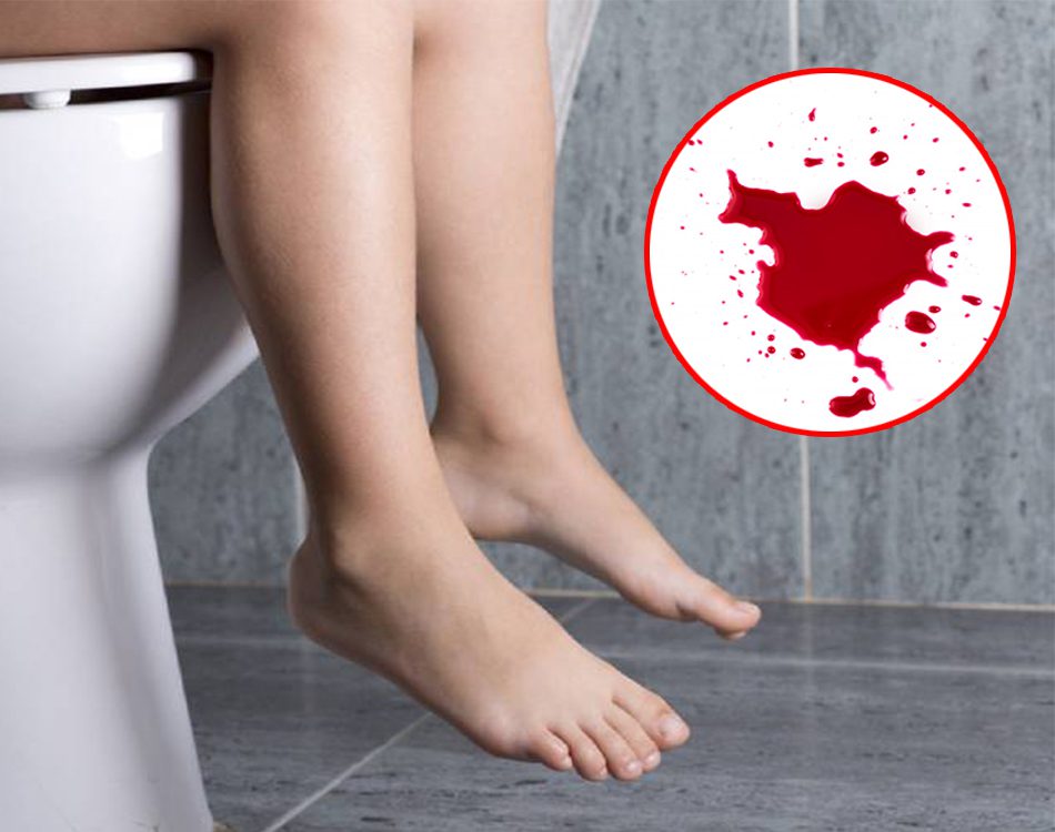 Nguyên Nhân Viêm Loét Dạ Dày Đi Ngoài Ra Máu Và Cách Điều Trị Kịp Thời