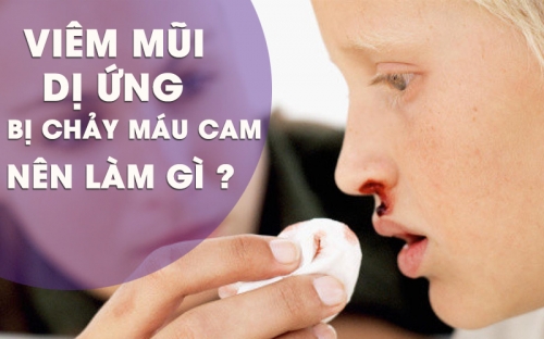 Viêm Mũi Dị Ứng Bị Chảy Máu Cam, Có Hay Không?