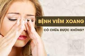Bệnh Viêm Xoang Có Chữa Được Không?